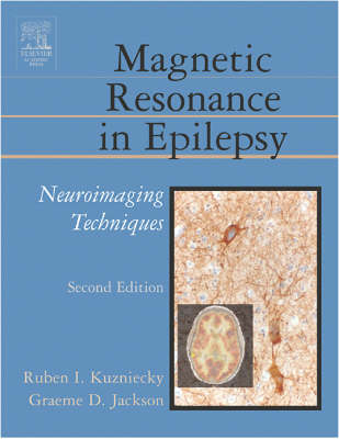 Magnetic Resonance in Epilepsy - Ruben Kuzniecky, Graeme D. Jackson