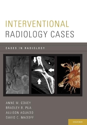 Interventional Radiology Cases - Anne M. Covey, Bradley P. Pua, Allison Aguado, David C. Madoff
