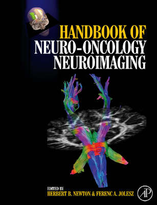 Handbook of Neuro-Oncology Neuroimaging - 