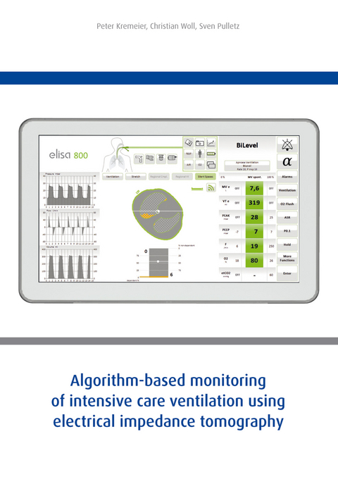 Algorithm-based monitoring of intensive care ventilation using electrical impedance tomography -  Kremeier,  Peter;  Woll,  Chrisitan;  Pulletz,  Sven