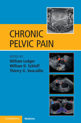 Chronic Pelvic Pain - 