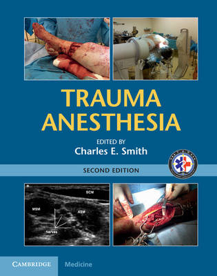 Trauma Anesthesia - 