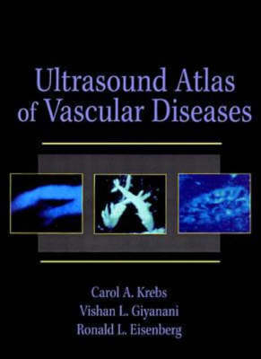 Ultrasound Atlas of Vascular Diseases - Carol Krebs,  etc., Vishan L. Giyanani, Ronald L. Eisenberg