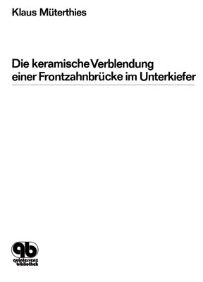 Die keramische Verblendung einer Frontzahnbrücke im Unterkiefer - Klaus Müterthies