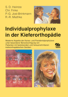 Individualprophylaxe in der Kieferorthopädie - Siegward D Heintze, Christian Finke, Paul G Jost-Brinkmann, Rainer R Miethke