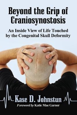 Beyond the Grip of Craniosynostosis - Kase D. Johnstun