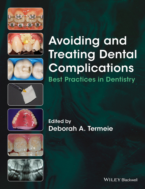 Avoiding and Treating Dental Complications - 