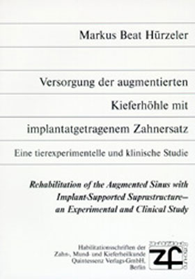 Versorgung der augmentierten Kieferhöhle mit implantatgetragenem Zahnersatz - Markus B Hürzeler