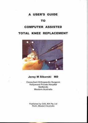 A Users Guide to Computer Assisted Total Knee Replacement - Jerry Sikorski