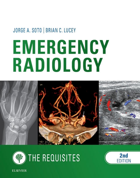 Emergency Radiology: The Requisites -  Brian C Lucey,  Jorge A Soto