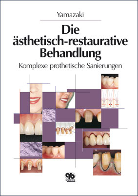 Ästhetisch-restaurative Behandlung - Masao Yamazaki