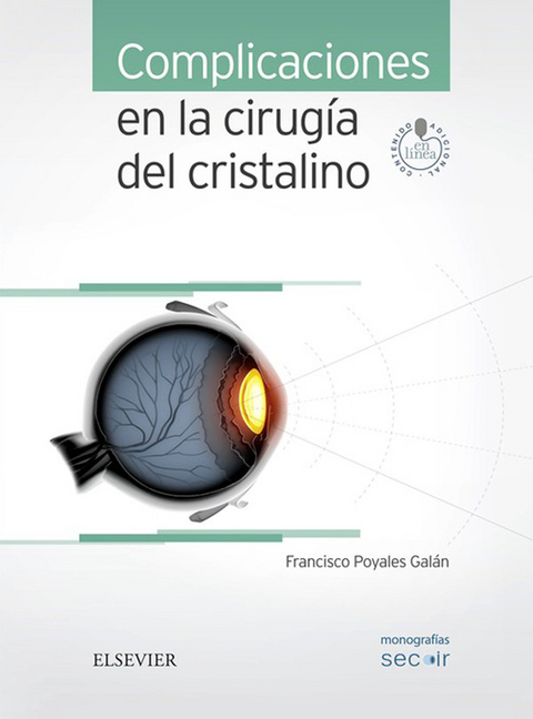 Complicaciones en la cirugía del cristalino - 