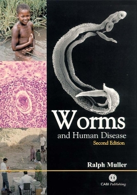 Worms and Human Disease - Ralph Muller