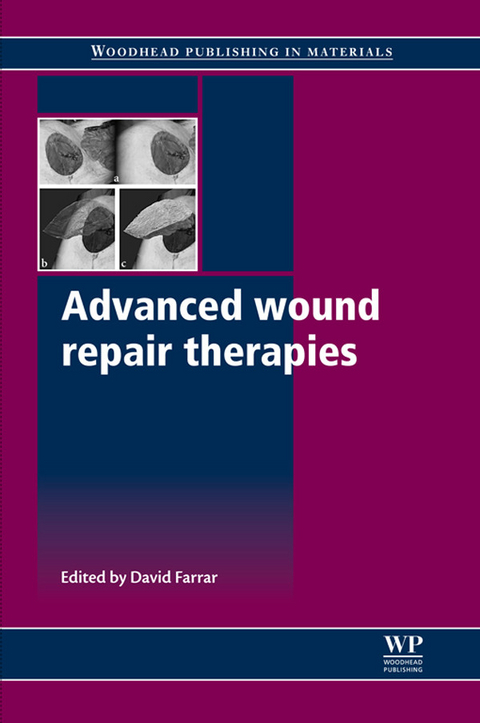 Advanced Wound Repair Therapies - 