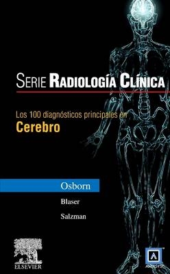 Serie Radiolog�a Cl�nica: Los 100 Diagn�sticos Principales En Cerebro - Anne G Osborn