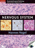 Nervous System - Hannes Vogel