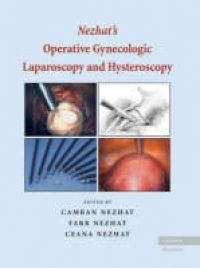 Nezhat's Operative Gynecologic Laparoscopy and Hysteroscopy - Camran Nezhat, Farr Nezhat, Ceana Nezhat
