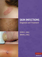 Skin Infections - Brian J. Hall