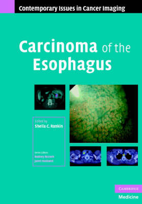 Carcinoma of the Esophagus - 