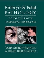 Embryo and Fetal Pathology - Enid Gilbert-Barness, Diane Debich-Spicer