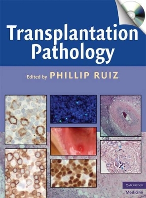 Transplantation Pathology - 