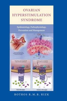 Ovarian Hyperstimulation Syndrome - Botros Rizk