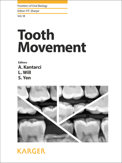 Tooth Movement - 