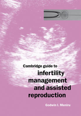 Cambridge Guide to Infertility Management and Assisted Reproduction - Godwin I. Meniru