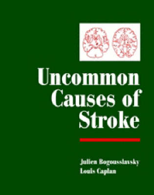 Uncommon Causes of Stroke - 