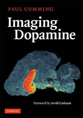 Imaging Dopamine - Paul Cumming