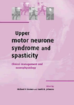 Upper Motor Neurone Syndrome and Spasticity - 