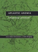 Aplastic Anemia - 