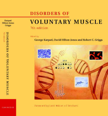 Disorders of Voluntary Muscle - 