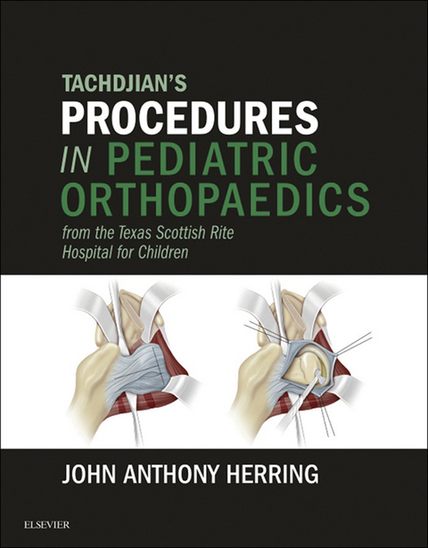 Tachdjian's Procedures in Pediatric Orthopaedics -  John A. Herring
