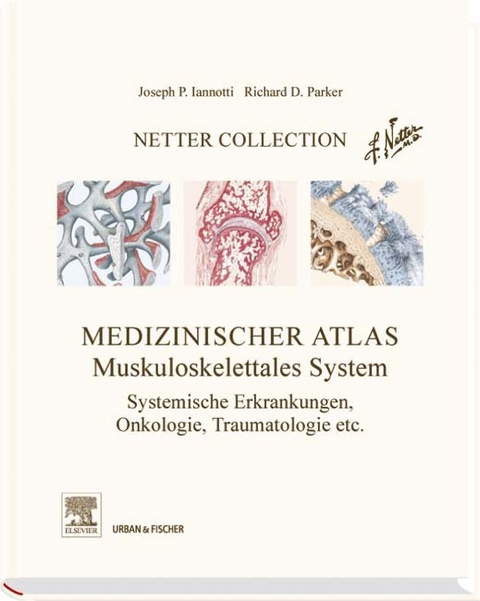 Netter Collection  Muskuloskelettales System Band 3 -  Iannotti