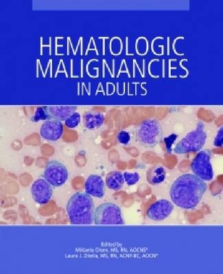 Hematologic Malignancies in Adults - 