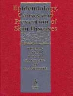 Epidemiology, Causes and Prevention of Skin Disease - 