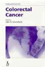 Challenges in Colorectal Cancer - 