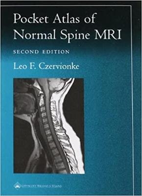 Pocket Atlas of Spinal MRI - Leo F. Czervionke
