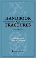 Rockwood's Handbook of Fractures - Kenneth J. Koval, Joseph D. Zuckerman