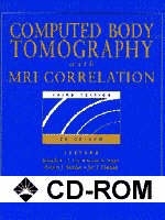 Computed Body Tomography with MRI Correlation - Joseph K.T. Lee, Stuart S. Sagel, Robert J. Stanley, Jay P. Heiken