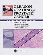 Gleason Grading of Prostate Cancer - Mahul B. Amin, David J. Grignon, Peter A. Humphrey, John Srigley