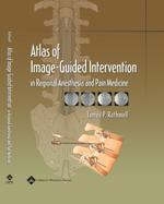 Atlas of Image-Guided Intervention in Regional Anesthesia and Pain Medicine - James P. Rathmell