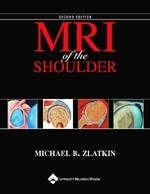 MRI of the Shoulder - Michael B. Zlatkin