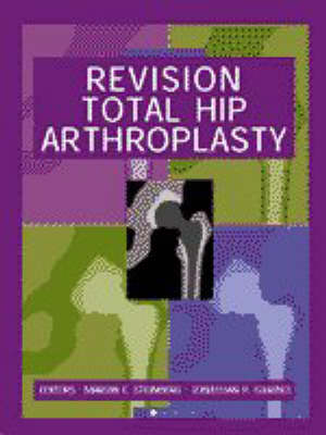 Revision Total Hip Arthroplasty - Marvin E. Steinberg, Jonathan P. Garino