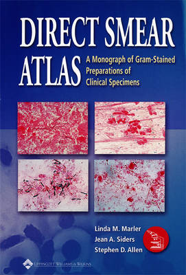 The Direct Smear Atlas - Linda M. Marler, Jean A. Siders, Stephen D. Allen