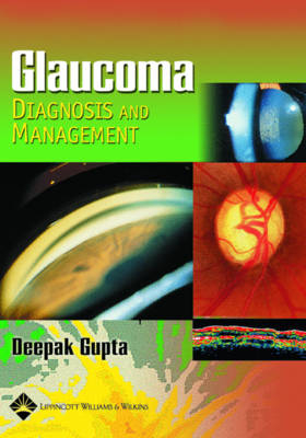 Glaucoma Diagnosis and Management - Deepak Gupta