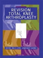 Revision Total Knee Arthroplasty - Paul A. Lotke, Jonathan P. Garino