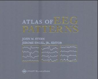 Atlas of EEG Patterns - John M. Stern