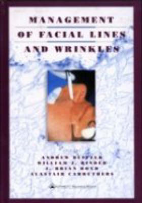 Management of Facial Lines and Wrinkles - 